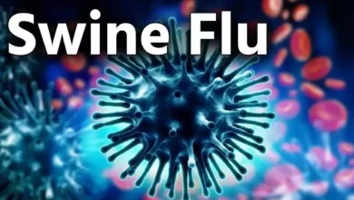 छत्तीसगढ़, स्वाइन फ्लू,संक्रमण, दुर्ग, स्वाइन फ्लू ,Chhattisgarh, swine flu, infection, Durg, swine flu,