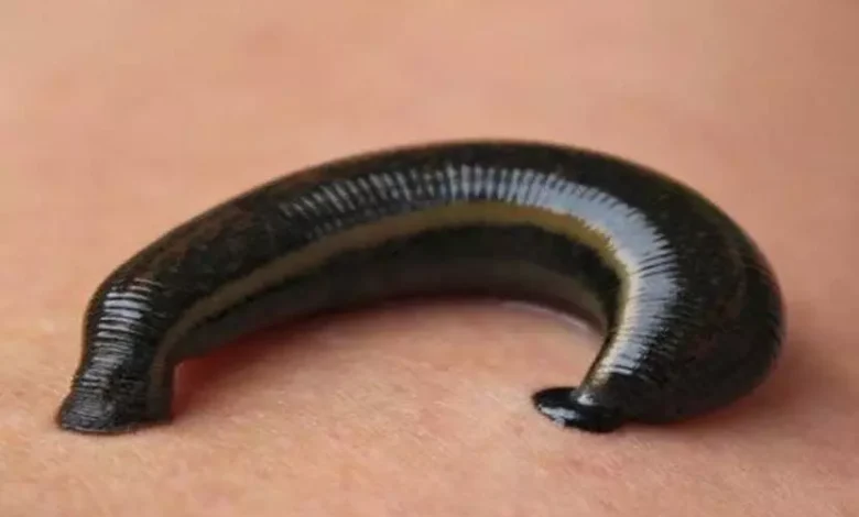 CRIME BREAKING, मासूम बच्ची , प्राइवेट पार्ट , डॉक्टरों , जोंक, Korba, कोरबा, तालाब ,CRIME BREAKING, innocent girl, private part, doctors, leech, Korba, Korba, pond,