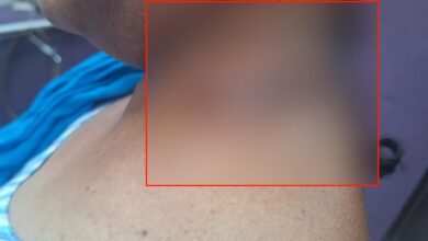 Raipur Breaking: जमीन विवाद को लेकर महिला पर किया जानलेवा हमला, FIR दर्ज