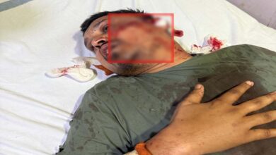 रायपुर जेल में पूर्व सीएम भूपेश बघेल के करीबी आशीष शिंदे पर जानलेवा हमला