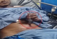 रायपुर। राजधानी रायपुर के आजाद चौक थाना क्षेत्र में देर शाम एक चाकू से किए गए हमले की घटना सामने आई है। जानकारी के अनुसार, मुकेश उर्फ दादू नामक युवक को एक नाबालिक द्वारा पेट पर चाकू मारकर गंभीर रूप से घायल कर दिया गया। घटना की गंभीरता को देखते हुए घायल को तत्काल रायपुर एम्स में भर्ती कराया गया, जहां उसका आपरेशन किया गया। आजाद चौक थाना प्रभारी अजीत राजपूत ने बताया कि हमले में इस्तेमाल चाकू इतना गहरा वार किया गया कि यह पीड़ित के पेट में फंस गया। प्रारंभिक जानकारी के अनुसार हमलावर नाबालिक है, जो किसी विवाद के कारण इस वारदात को अंजाम दिया। घायल मुकेश की हालत गंभीर बनी हुई है और डॉक्टर लगातार उसकी निगरानी कर रहे हैं। पुलिस ने मामले को गंभीरता से लेते हुए बीएस की धारा 109 के तहत हत्या के प्रयास का मामला दर्ज कर लिया है। जांच अधिकारी घटना स्थल पर पहुंचे और नाबालिक हमलावर की पहचान करने के लिए गहन जांच शुरू कर दी है। मामले में आसपास के लोगों से पूछताछ की जा रही है ताकि हमले के पीछे की वास्तविक वजह का पता लगाया जा सके। स्थानीय लोग बताते हैं कि आजाद चौक थाना क्षेत्र में अक्सर विवाद और नाबालिकों की छेड़छाड़ की घटनाएं सामने आती रहती हैं। इस मामले ने क्षेत्र में सुरक्षा को लेकर चिंता बढ़ा दी है। पुलिस ने यह भी कहा कि मामले में दोषियों के खिलाफ कड़ी कार्रवाई की जाएगी। इस तरह की हिंसक घटनाओं को रोकने के लिए निगरानी बढ़ाई जाएगी। घटना के बाद आसपास के लोग काफी डर और चिंता में हैं। पुलिस ने घटनास्थल को सील कर जांच शुरू कर दी है। प्रारंभिक रिपोर्ट के अनुसार, घायल का स्वास्थ्य खतरे में है, लेकिन डॉक्टरों ने ऑपरेशन के बाद स्थिति को नियंत्रित बताया है। पुलिस का कहना है कि ऐसे मामलों में नाबालिकों के लिए विशेष प्रावधानों के तहत कार्रवाई की जाएगी और न्यायिक प्रक्रिया पूरी तरह से लागू की जाएगी। इसी क्रम में अब जांच अधिकारी इस बात की पुष्टि कर रहे हैं कि क्या यह व्यक्तिगत विवाद था या किसी और कारण से यह हमला किया गया। घटना ने राजधानी के आजाद चौक इलाके में सुरक्षा व्यवस्था को लेकर एक बार फिर सवाल खड़ा कर दिया है। पुलिस प्रशासन ने आश्वासन दिया है कि इस घटना की गहन जांच की जाएगी और भविष्य में इस तरह की वारदात को रोकने के लिए कदम उठाए जाएंगे।